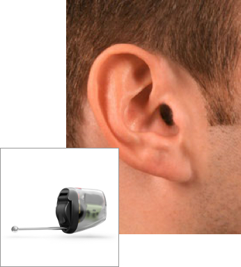 IIC style hearing aid in ear